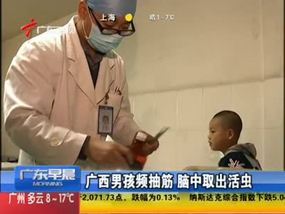 男孩吃青蛙肉频抽搐 脑中取出10cm寄生虫