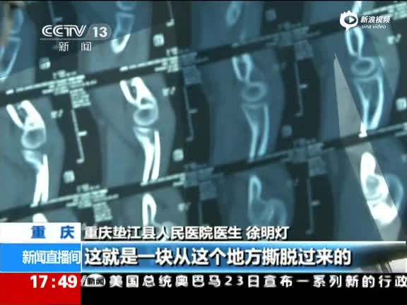 癌症患者死亡 死者家属打伤医生